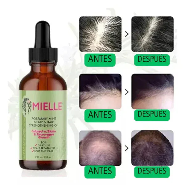 NO SUFRAS MAS: DILE ADIOS A LA PERDIDA DEL CABELLO CON NUSTRO TONICO CONTROL CAIDA. PAGA 1 LLEVA 2