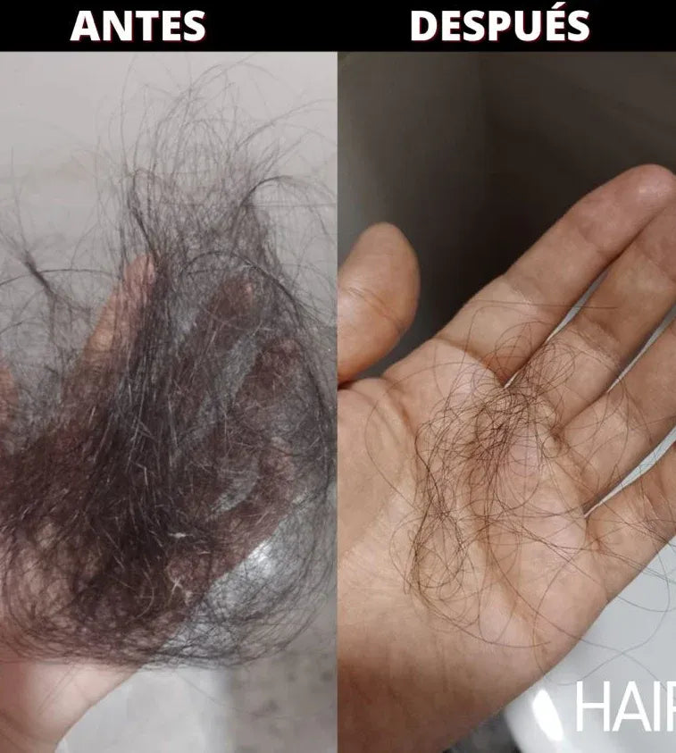 NO SUFRAS MAS: DILE ADIOS A LA PERDIDA DEL CABELLO CON NUSTRO TONICO CONTROL CAIDA. PAGA 1 LLEVA 2
