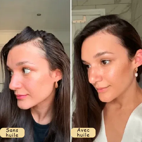 NO SUFRAS MAS: DILE ADIOS A LA PERDIDA DEL CABELLO CON NUSTRO TONICO CONTROL CAIDA. PAGA 1 LLEVA 2