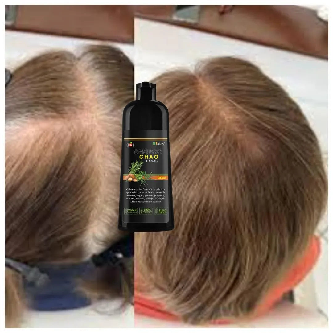 SHAMPOO CHAO CANAS 3 EN 1 ➕ TRATAMIENTO ACTIVADOR