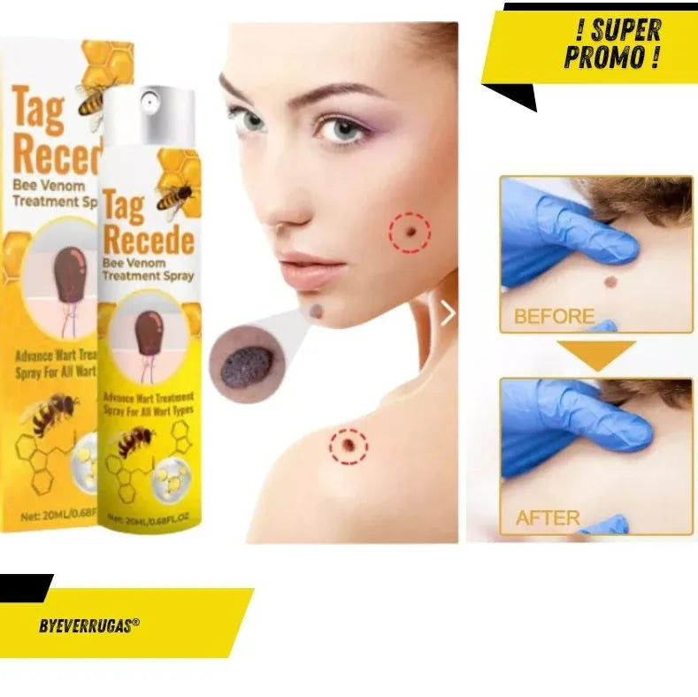 Tag Recede Eliminador de verrugas⭐⭐⭐⭐⭐,,(ENVIO GRATIS 🔥)PAGO CONTRA ENTREGA🚛