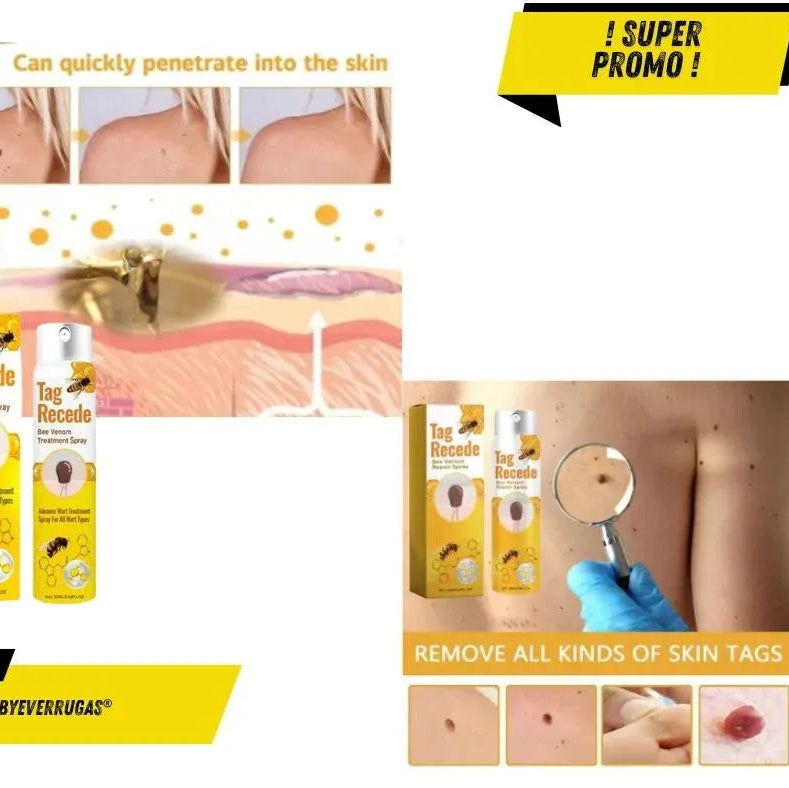 Tag Recede Eliminador de verrugas⭐⭐⭐⭐⭐,,(ENVIO GRATIS 🔥)PAGO CONTRA ENTREGA🚛