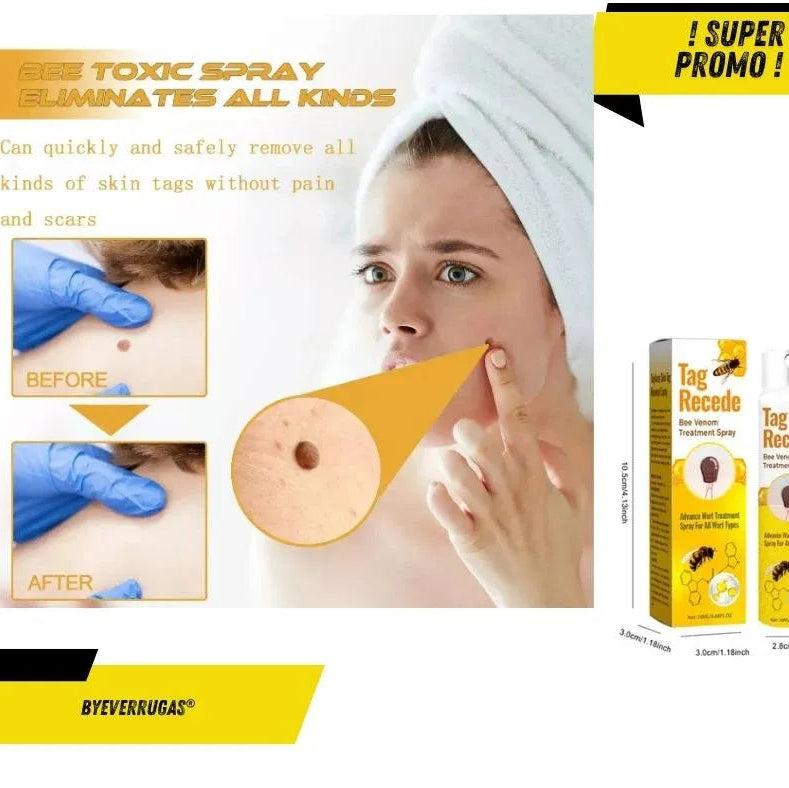 Tag Recede Eliminador de verrugas⭐⭐⭐⭐⭐,,(ENVIO GRATIS 🔥)PAGO CONTRA ENTREGA🚛