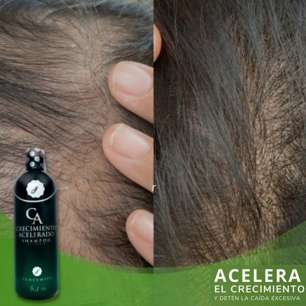 PowerHair® - Shampoo Crecimiento Acelerado + Obsequio